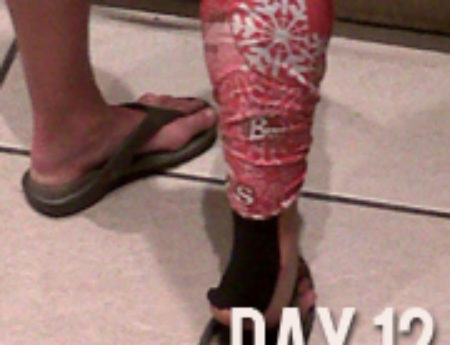 Day 12 – How bizarre