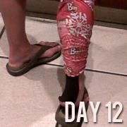 Day 12 – How bizarre